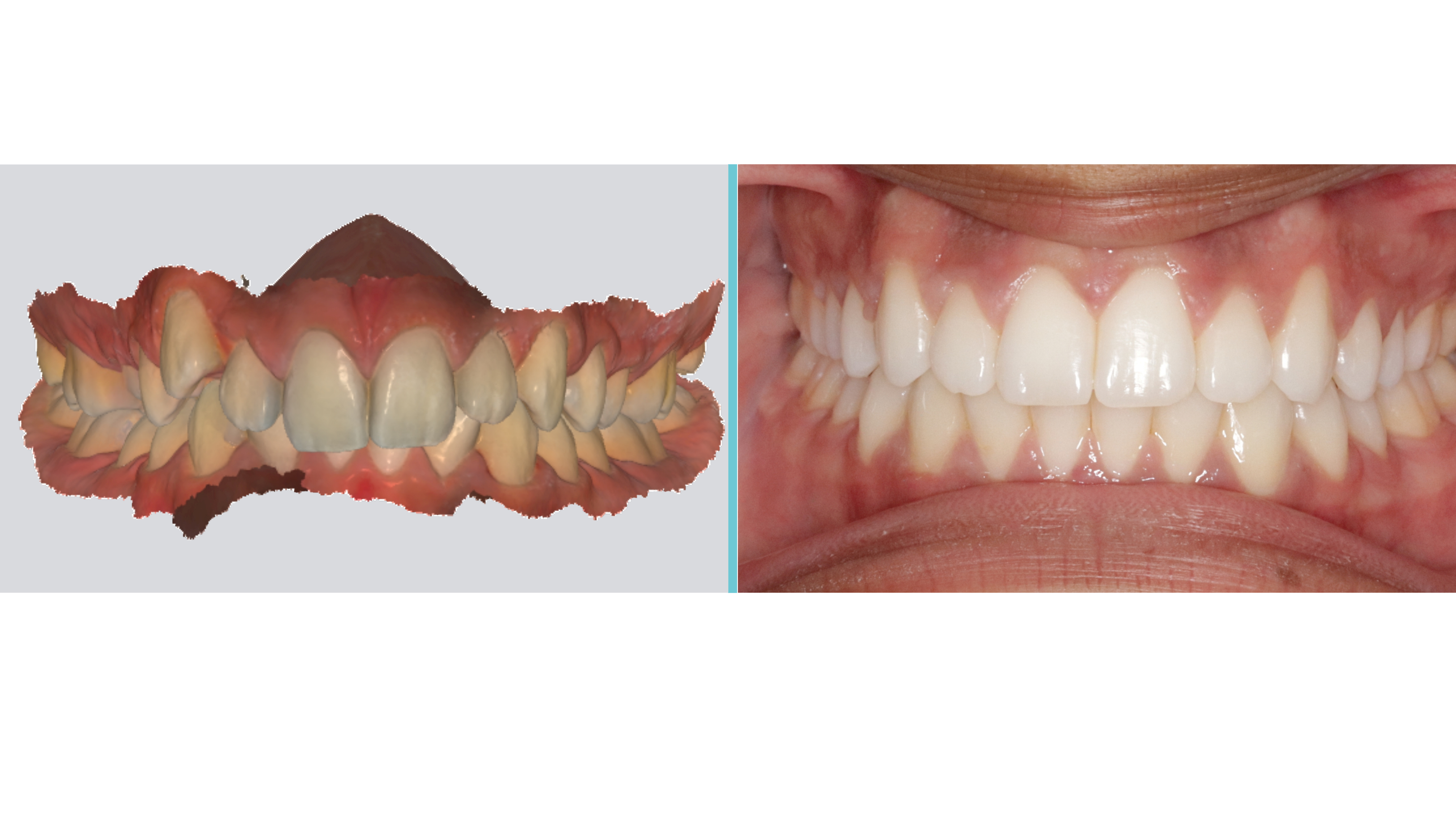 Gianquinto Center Shots Case Study 4 (1)