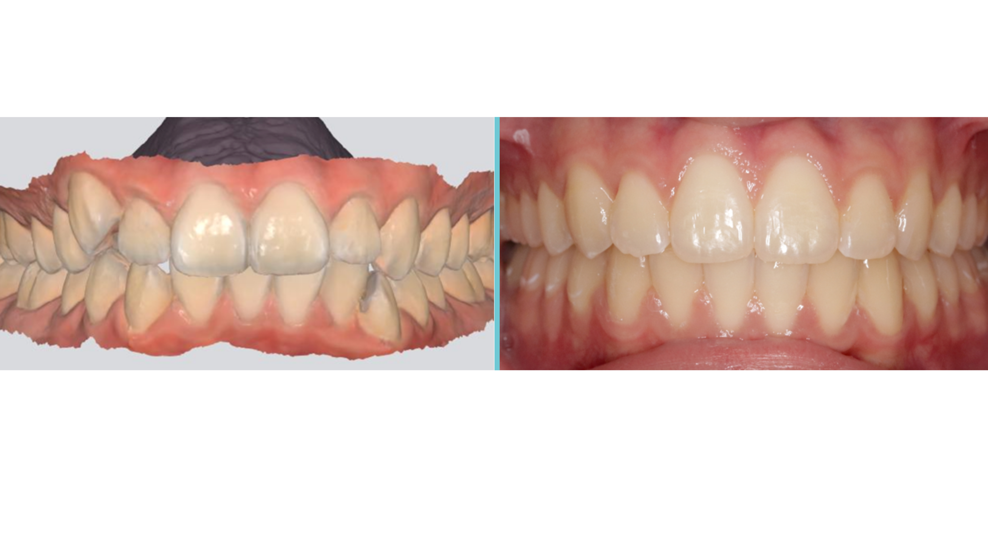 Gianquinto MSL Case Study 1