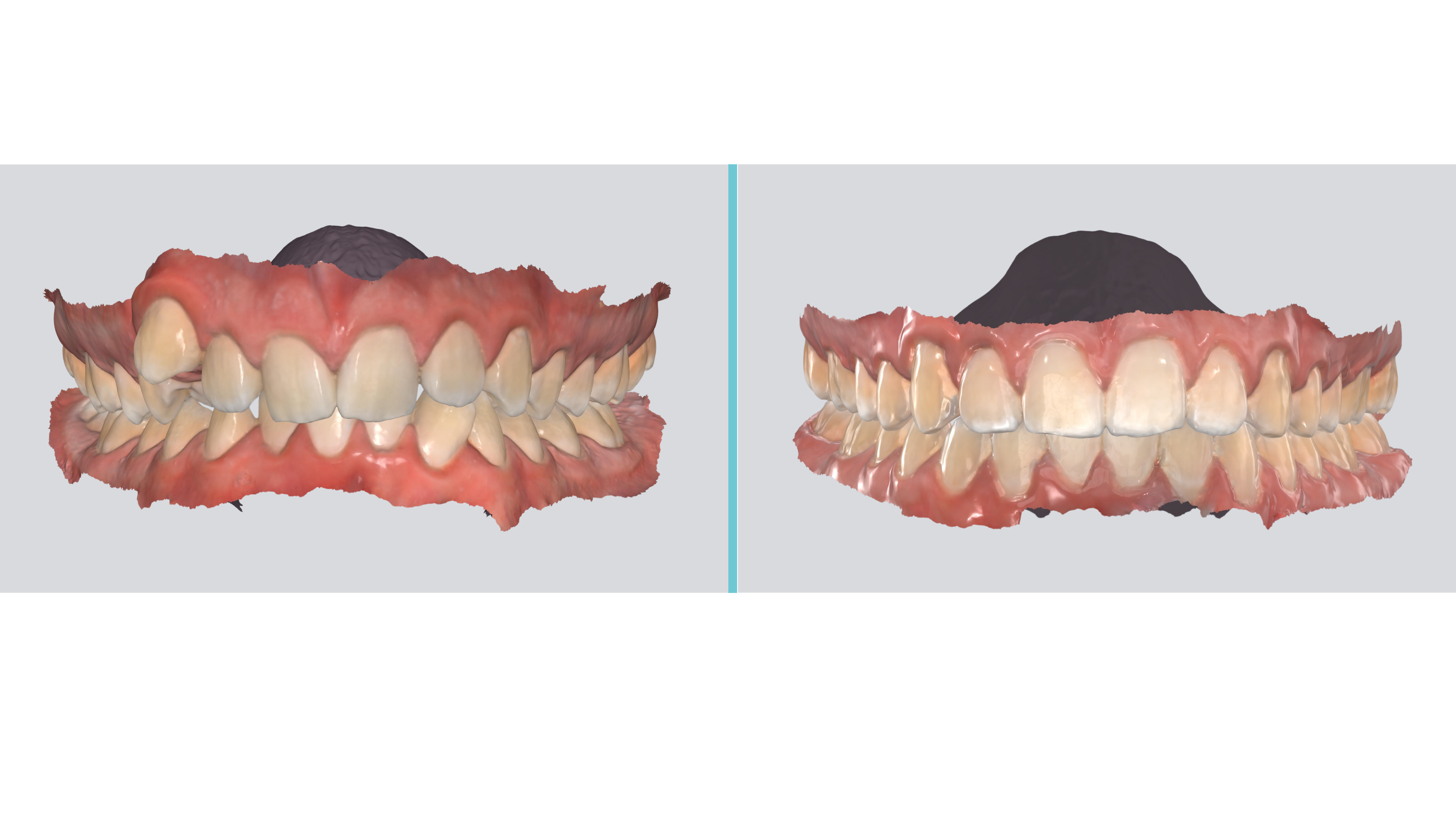 Trotter - Center Shot Case Study 4